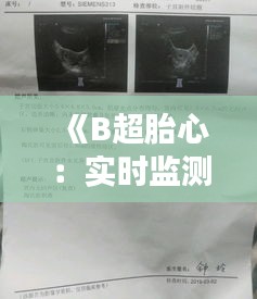 《B超胎心：实时监测，守护母婴健康的关键》