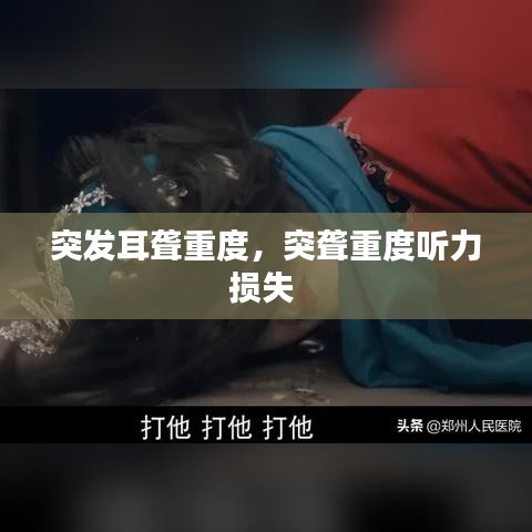 突发耳聋重度，突聋重度听力损失 