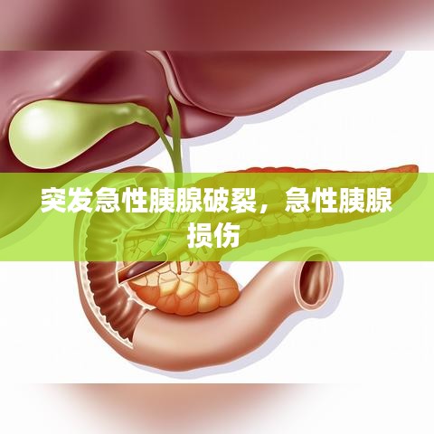 突发急性胰腺破裂，急性胰腺损伤 